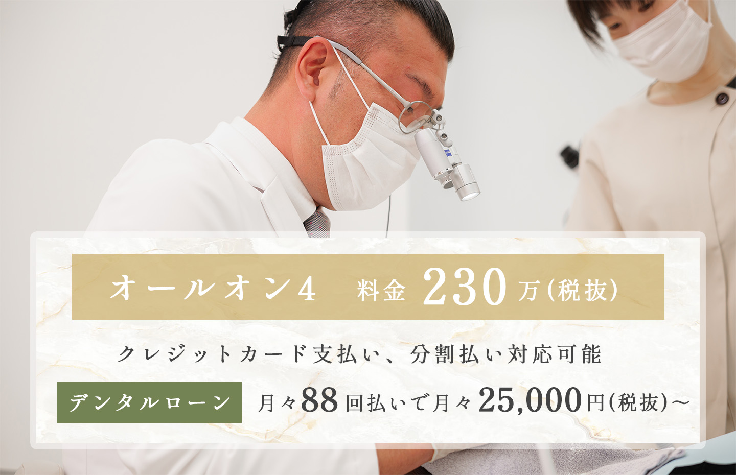 オールオン4料金