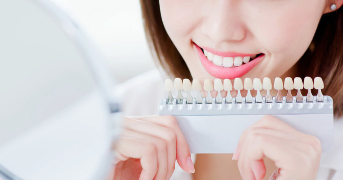白く輝く笑顔へ——ホワイトニングのご案内