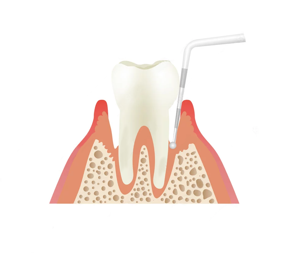 糖尿病は歯周病を悪化させる？歯科でできる血糖コントロール対策
